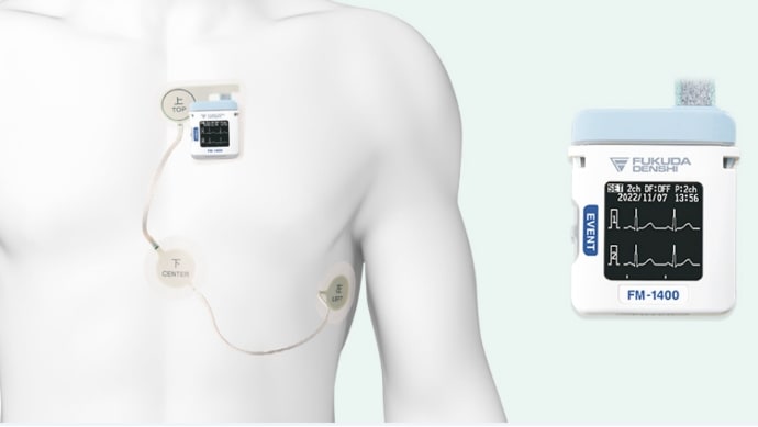 ホルター心電図