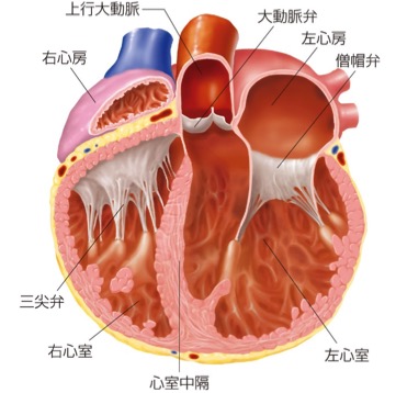 拡張型心筋症の例　左心室の拡張が僧帽弁閉鎖不全症の原因となる