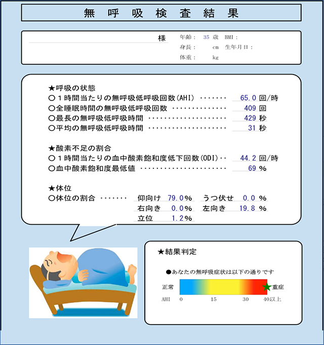睡眠時無呼吸検査