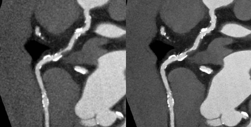 高精細画像再構成