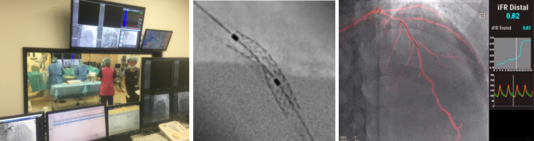 ハイブリッドオペ室（Hybrid OR)